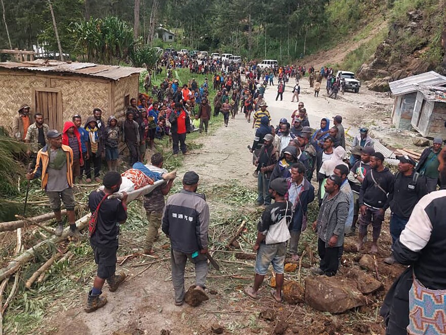 In this photo provided by the International Organization for Migration, an injured person is carried on a stretcher to seek medical assistance after a landslide in Yambali village, Papua New Guinea, Friday, May 24, 2024. More than 100 people are believed to have been killed in the landslide that buried a village and an emergency response is underway, officials said. 