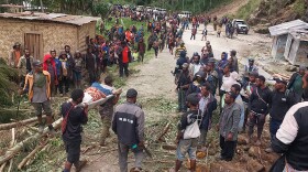 In this photo provided by the International Organization for Migration, an injured person is carried on a stretcher to seek medical assistance after a landslide in Yambali village, Papua New Guinea, Friday, May 24, 2024. More than 100 people are believed to have been killed in the landslide that buried a village and an emergency response is underway, officials said. 