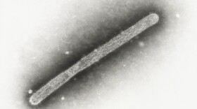 This 2005 electron microscope image shows an avian influenza A H5N1 virion. On Wednesday, May 22, 2024, Michigan health officials said a farmworker has been diagnosed with bird flu, the second human case connected to an outbreak in U.S. dairy cows. (Cynthia Goldsmith, Jackie Katz/CDC via AP)