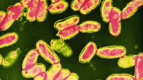 False-color transmission electron micrograph of a field of whooping cough bacteria, <em>Bordetella pertussis</em>.